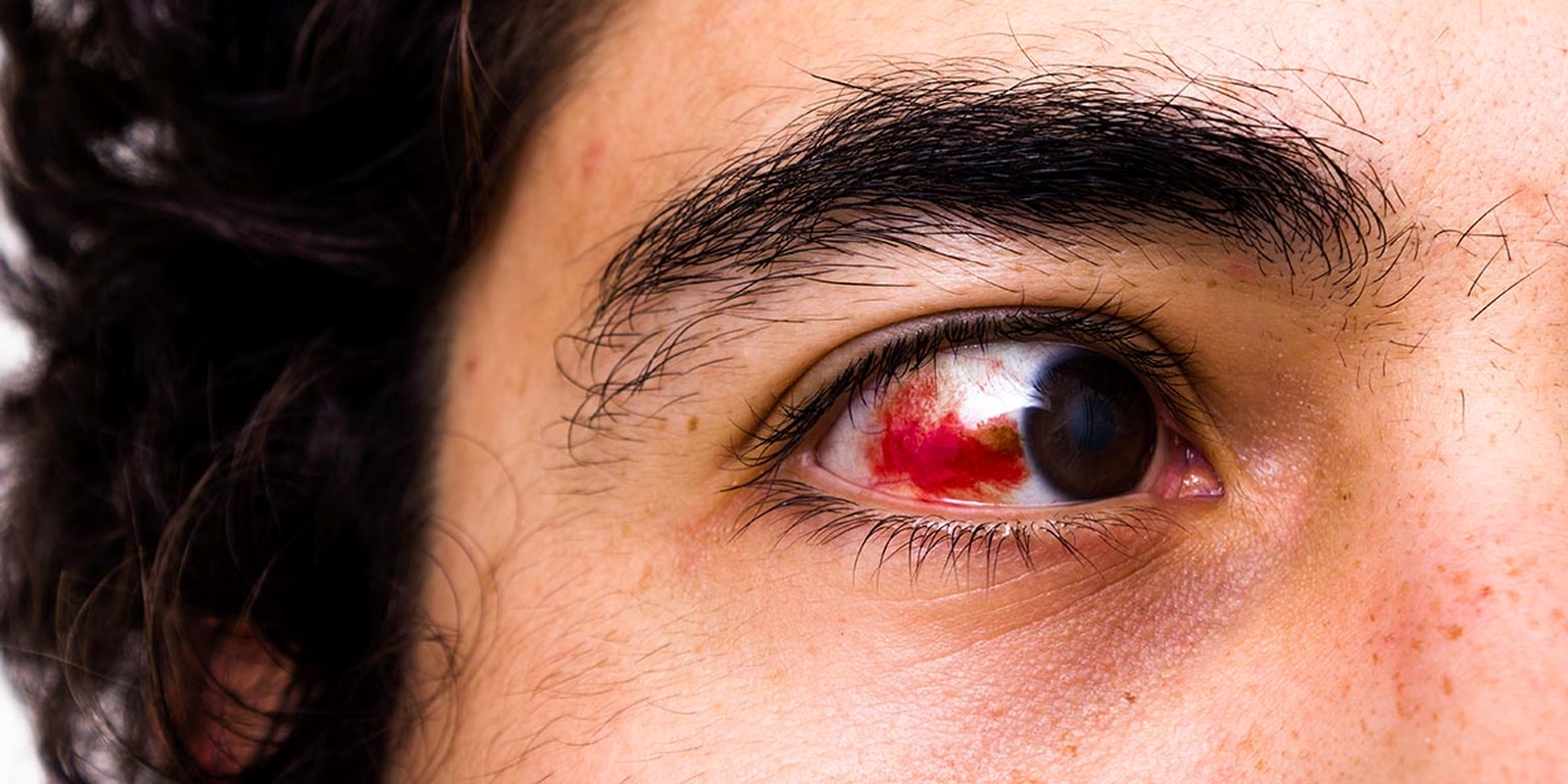 فشار چشم در غواصی (Mask Squeeze) چیست؟ فشار چشم در غواصی (Mask Squeeze) چیست؟